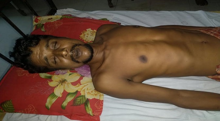 শালিসে ডেকে মারপিট; অভিযুক্ত ইউপি