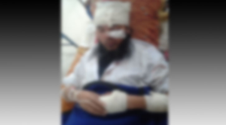 হবিগঞ্জে মসজিদের ইমামকে কুপিয়ে জখম