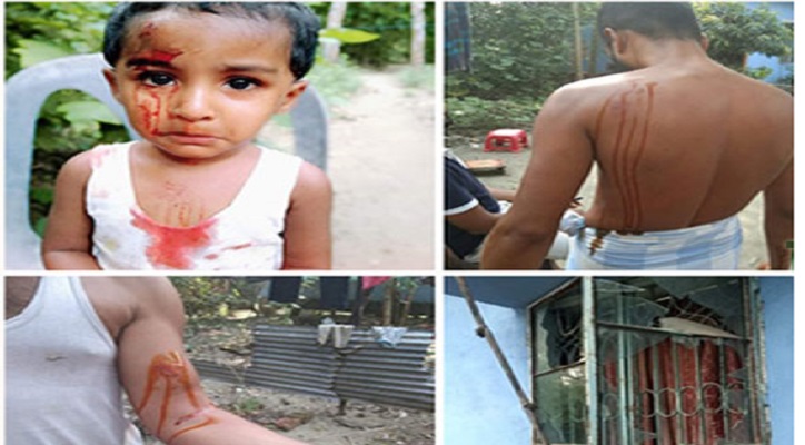 নাঙ্গলকোটে সাংবাদিকের বাড়ীতে সন্ত্রাসী হামলা,আহত-৩