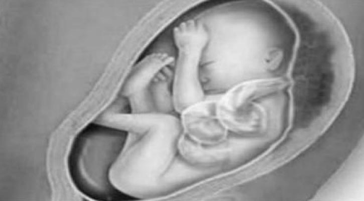 আগামী বছর কমপক্ষে ২ লাখ মৃত শিশুর জন্ম হতে পারে