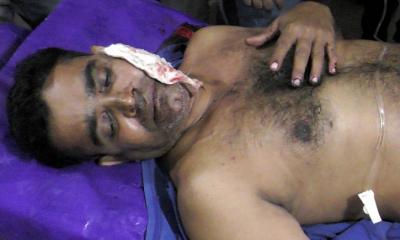 নড়াইলে কৃষক লীগ নেতাকে গুলি