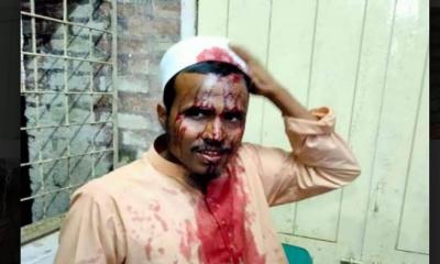 শ্রীপুরে ওলামা লীগ নেতাকে কুপিয়ে আহত করার অভিযোগ