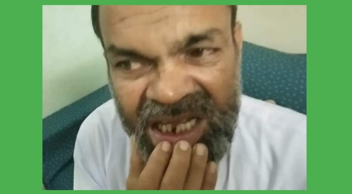 ম্যানেজিং কমিটির সভাপতির ঘুষিতে দাঁত পড়ল প্রধান শিক্ষকের
