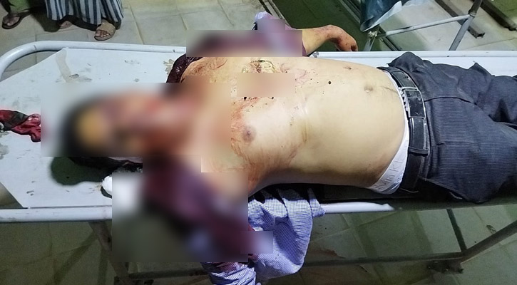 আখাউড়ায় সড়ক দুর্ঘটনায় শিশুসহ নিহত ২, আহত ৫