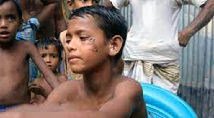 অচেনা প্রাণীর আক্রমণে ইমাম নিহত, আহত ৩০